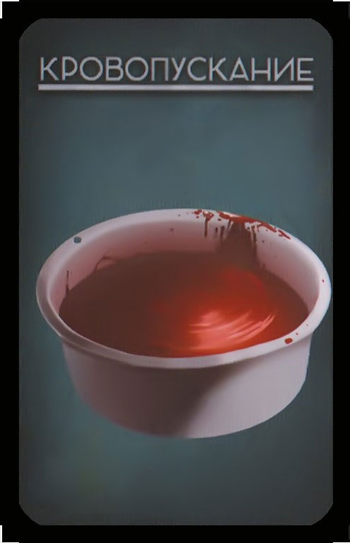 кровопускание